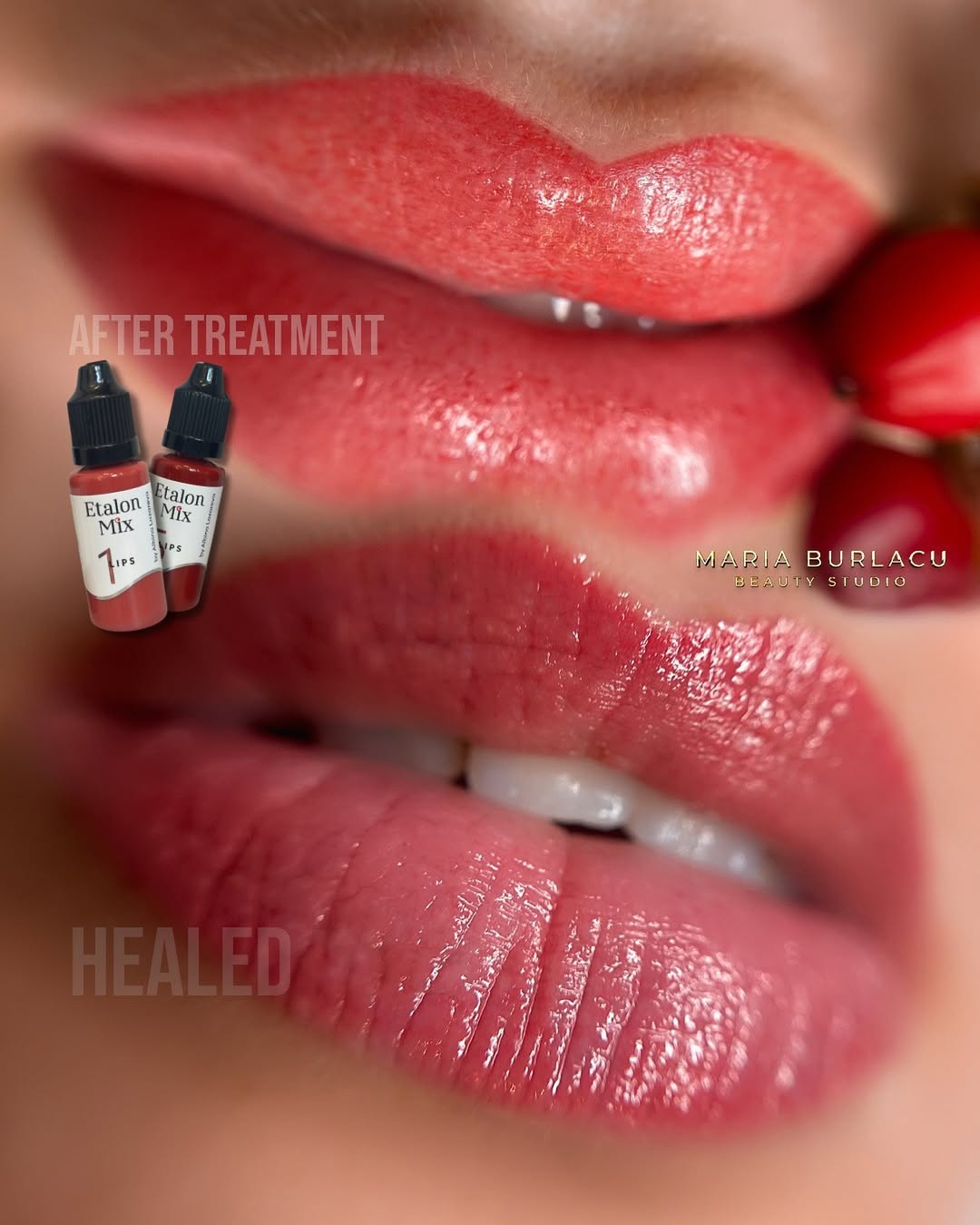 Healed lips result